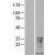 Western Blot: S100A9 Lysate [NBL1-15660] - Western Blot experiments. 
Left-Control; Right -Over-expression Lysate for S100A9